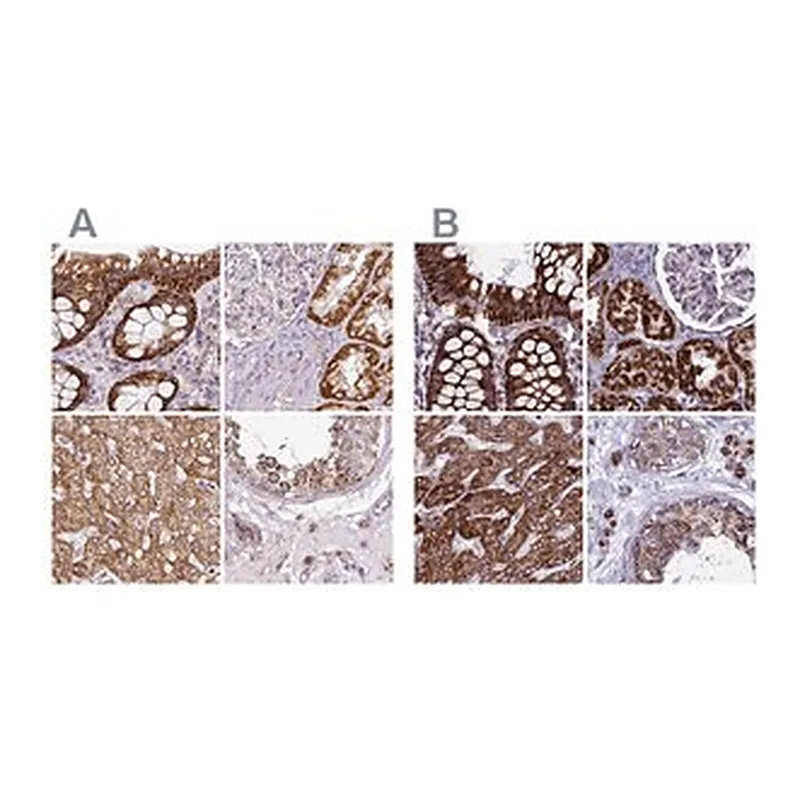 Merck Anti-UQCRFS1 antibody produced in rabbit