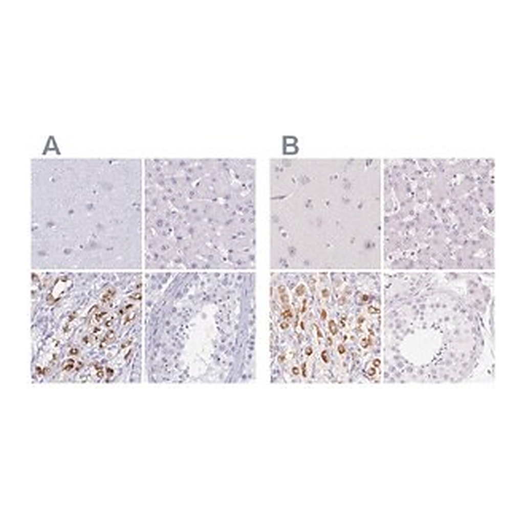 Merck Anti-KCNE2 antibody produced in rabbit
