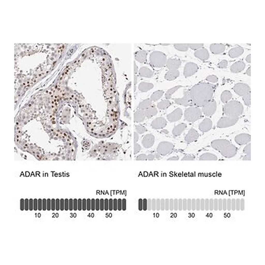 Merck Anti-ADAR antibody produced in rabbit