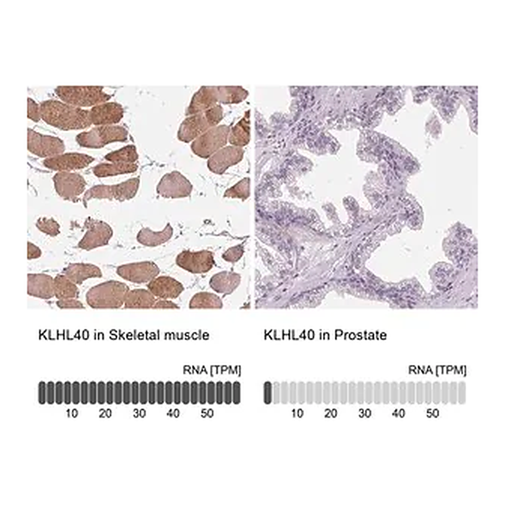 Merck Anti-KLHL40 antibody produced in rabbit