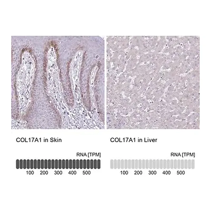 Merck Anti-COL17A1 antibody produced in rabbit