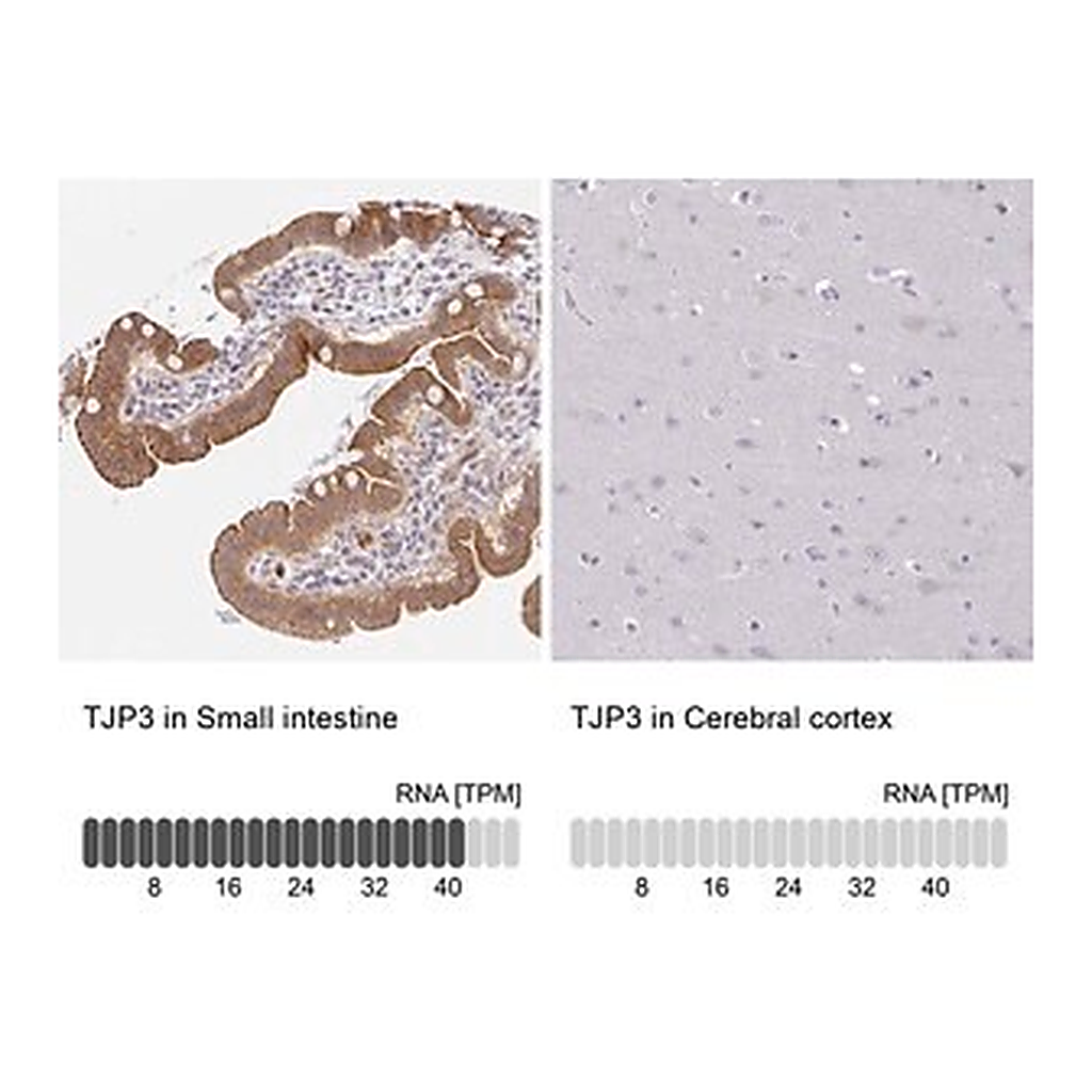 Merck Anti-TJP3 antibody produced in rabbit