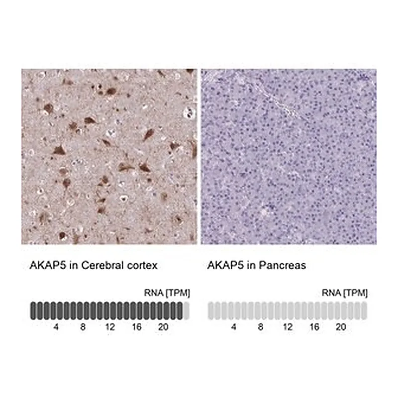 Merck Anti-AKAP5 antibody produced in rabbit