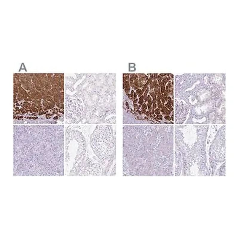 Merck Anti-CYP21A2 antibody produced in rabbit