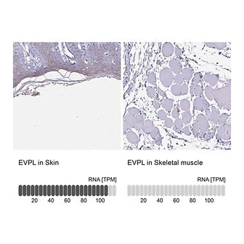 Merck Anti-EVPL antibody produced in rabbit