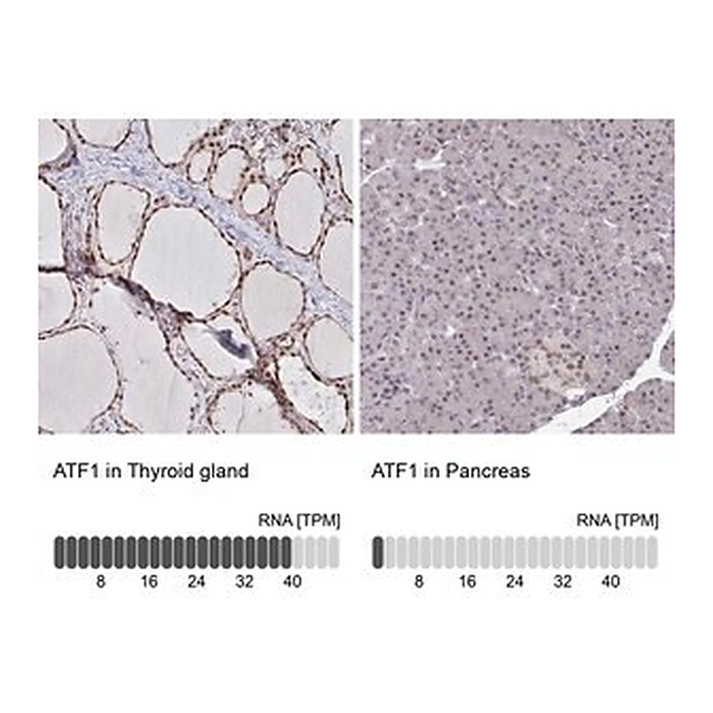 Merck Anti-ATF1 antibody produced in rabbit