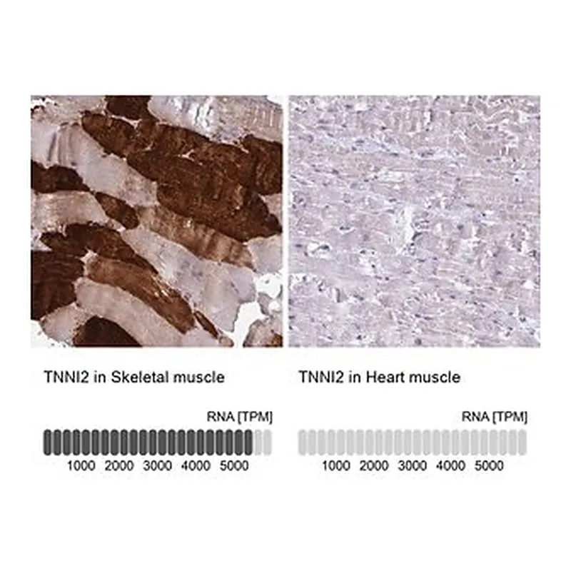 Merck Anti-TNNI2 antibody produced in rabbit