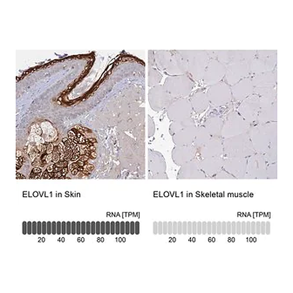 Merck Anti-ELOVL1 antibody produced in rabbit