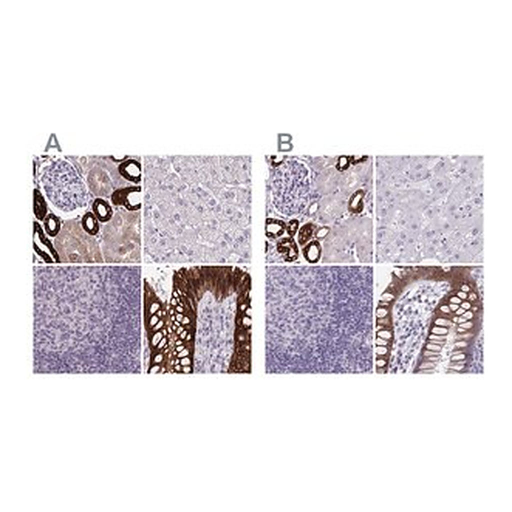 Merck Anti-HSD11B2 antibody produced in rabbit