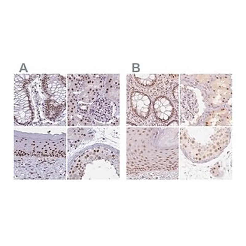 Merck Anti-PPP1R10 antibody produced in rabbit