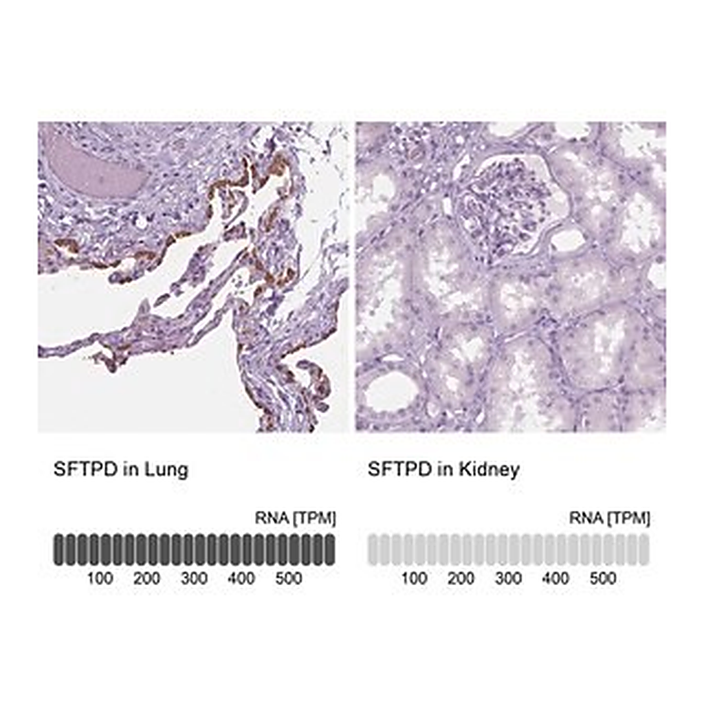 Merck Anti-SFTPD antibody produced in rabbit