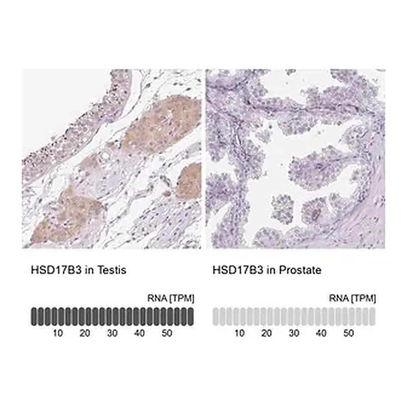 Merck Anti-HSD17B3 antibody produced in rabbit