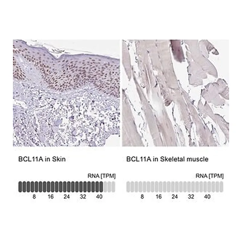 Merck Anti-BCL11A antibody produced in rabbit