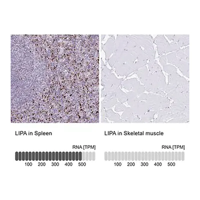 Merck Anti-LIPA antibody produced in rabbit
