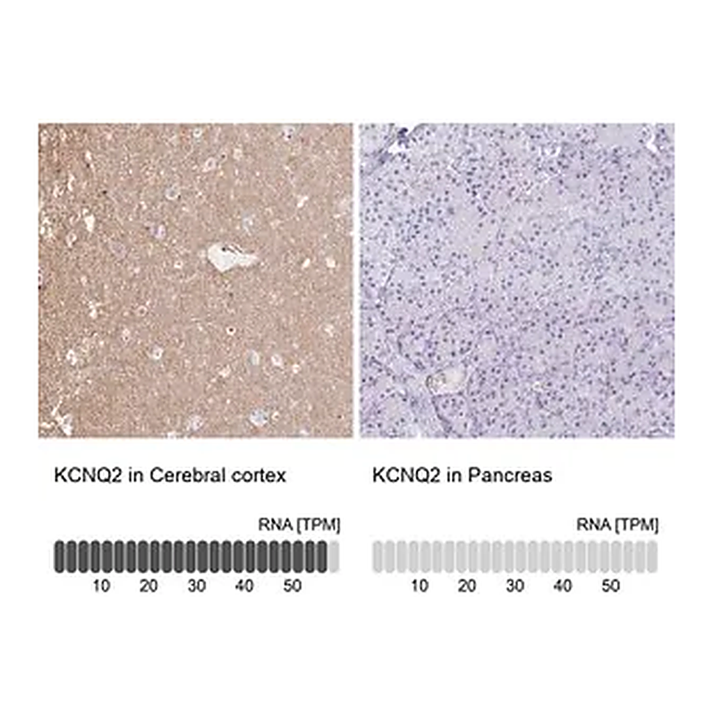 Merck Anti-KCNQ2 antibody produced in rabbit