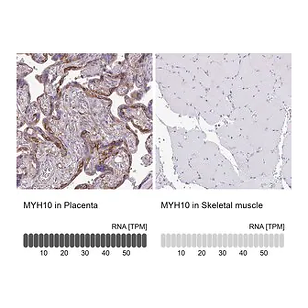 Merck Anti-MYH10 antibody produced in rabbit