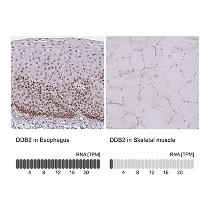 Merck Anti-DDB2 antibody produced in rabbit