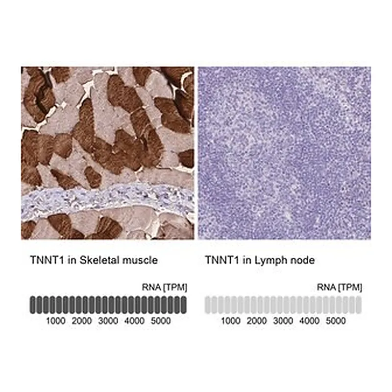 Merck Anti-TNNT1 antibody produced in rabbit