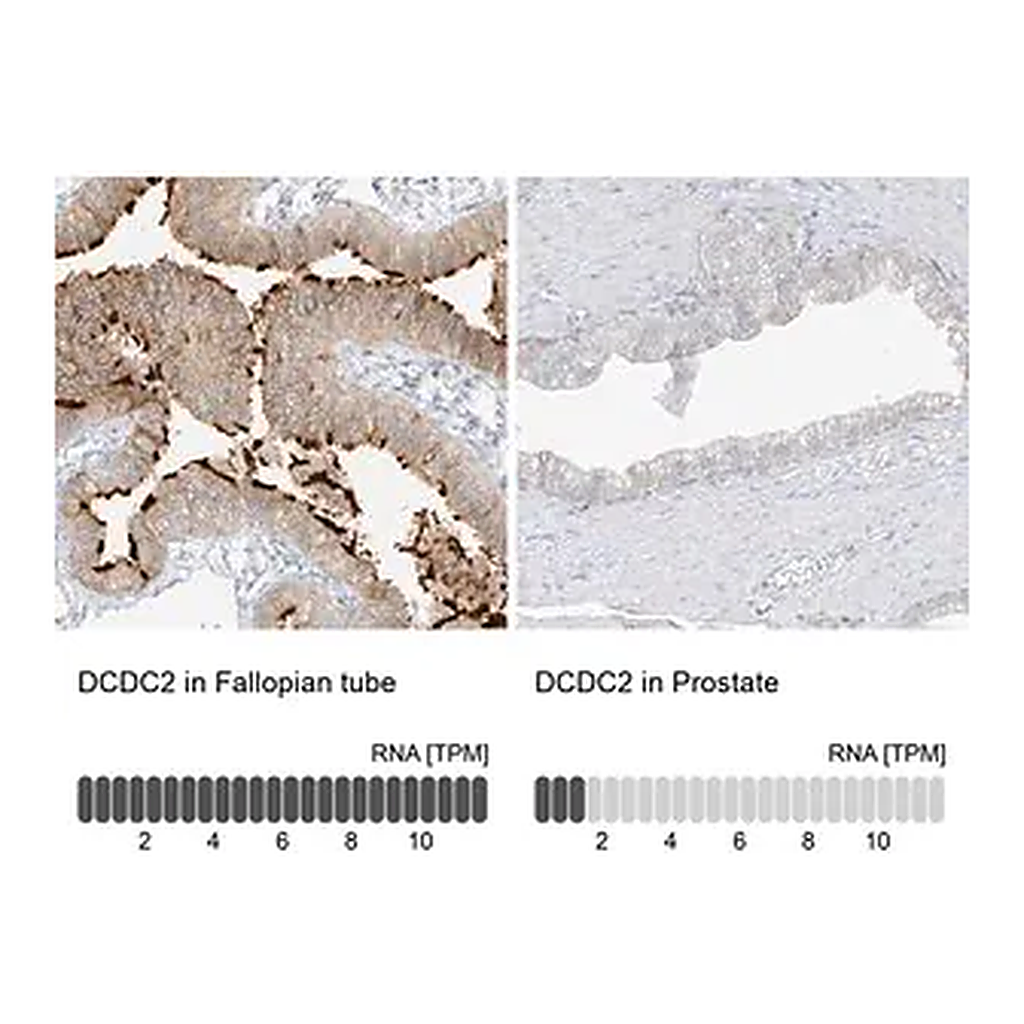 Merck Anti-DCDC2 antibody produced in rabbit