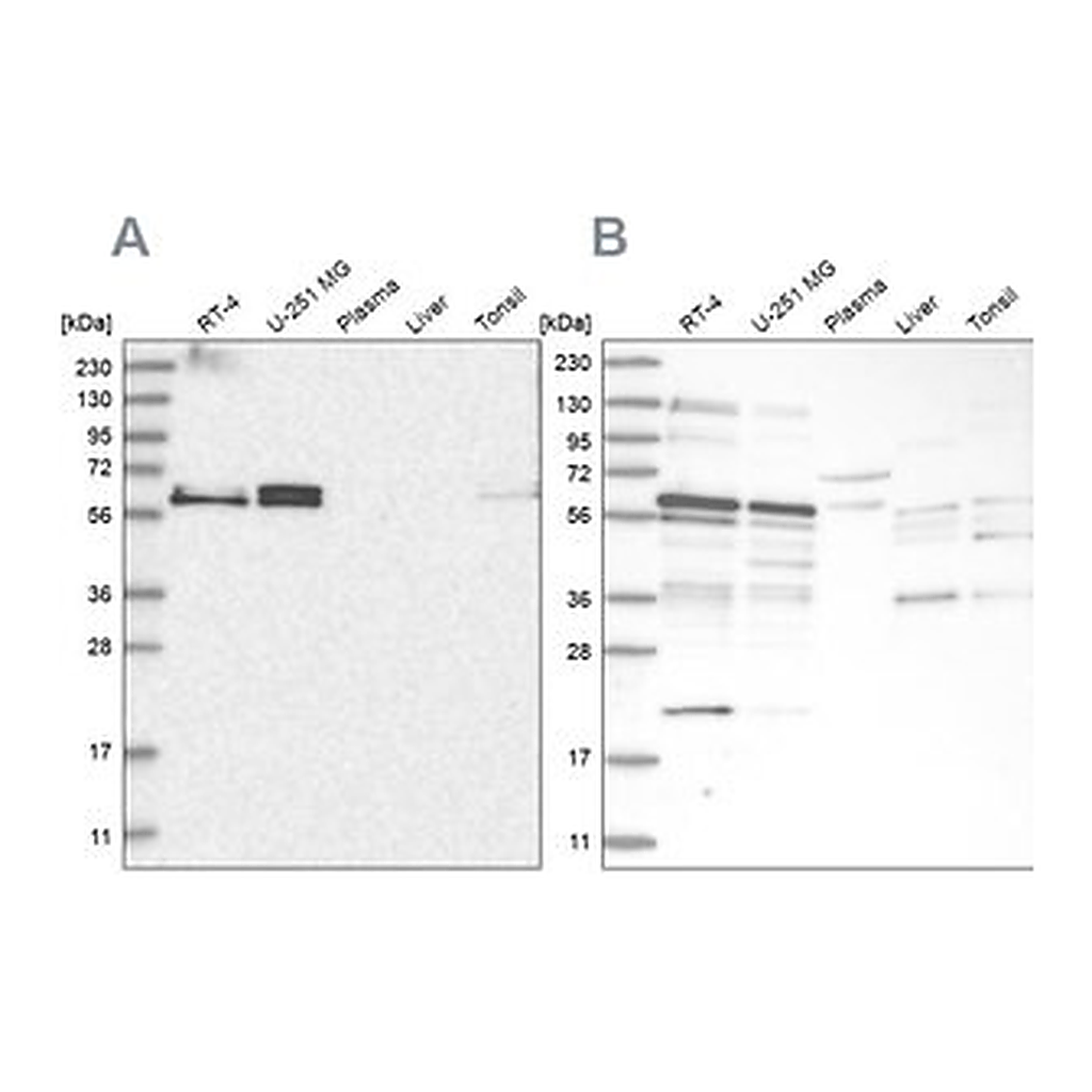 Merck Anti-TSPYL1 antibody produced in rabbit