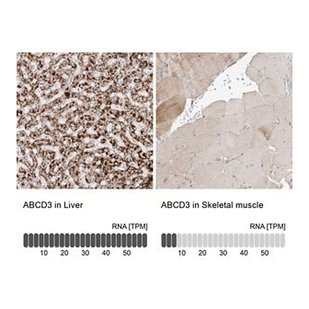 Merck Anti-ABCD3 antibody produced in rabbit