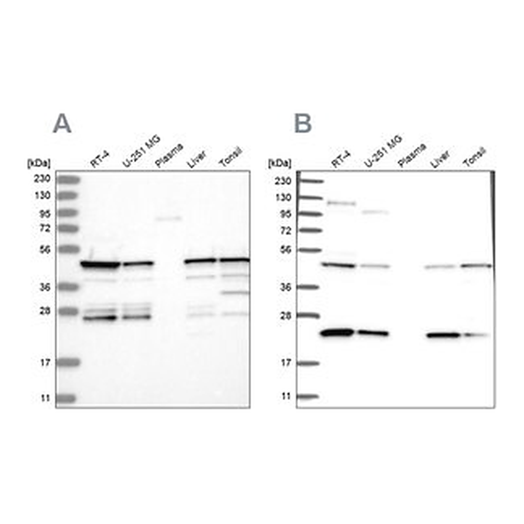 Merck Anti-PPP1R7 antibody produced in rabbit