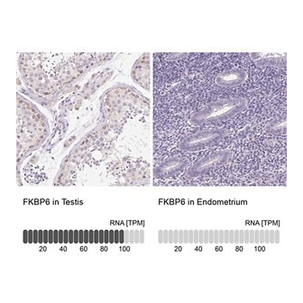 Merck Anti-FKBP6 antibody produced in rabbit