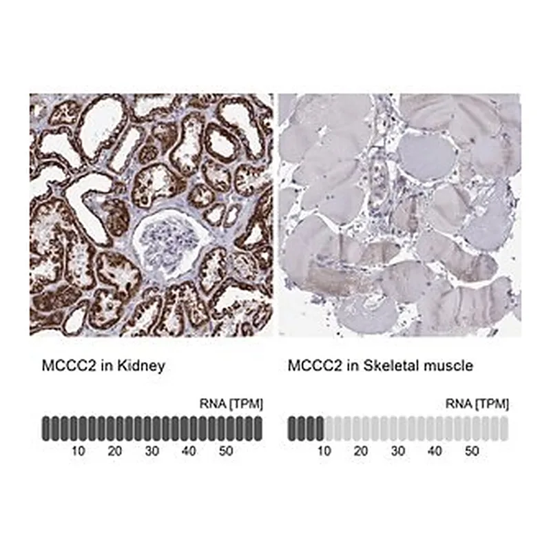 Merck Anti-MCCC2 antibody produced in rabbit