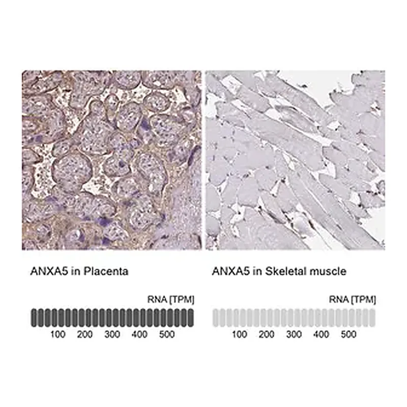 Merck Anti-ANXA5 antibody produced in rabbit