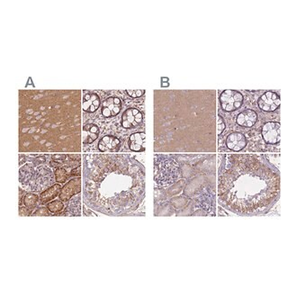 Merck Anti-ADD1 antibody produced in rabbit