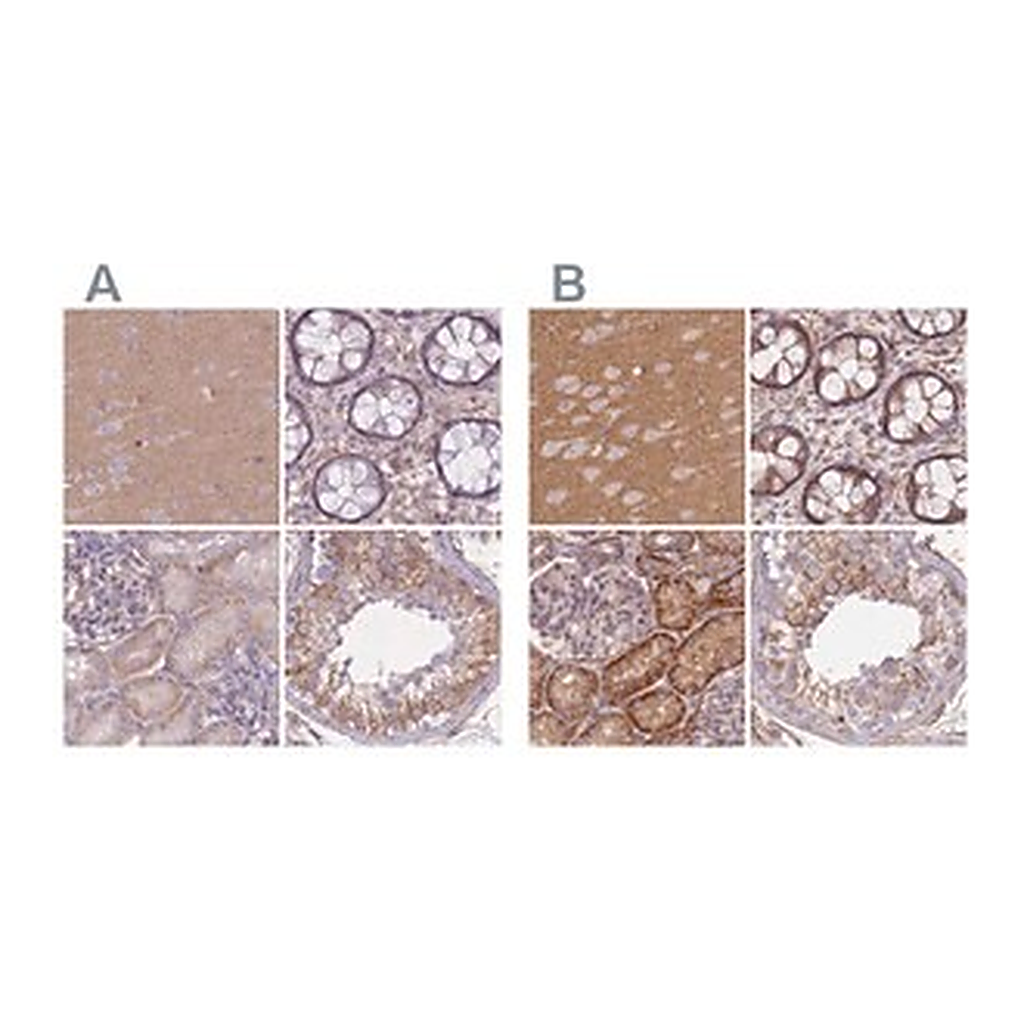 Merck Anti-ADD1 antibody produced in rabbit