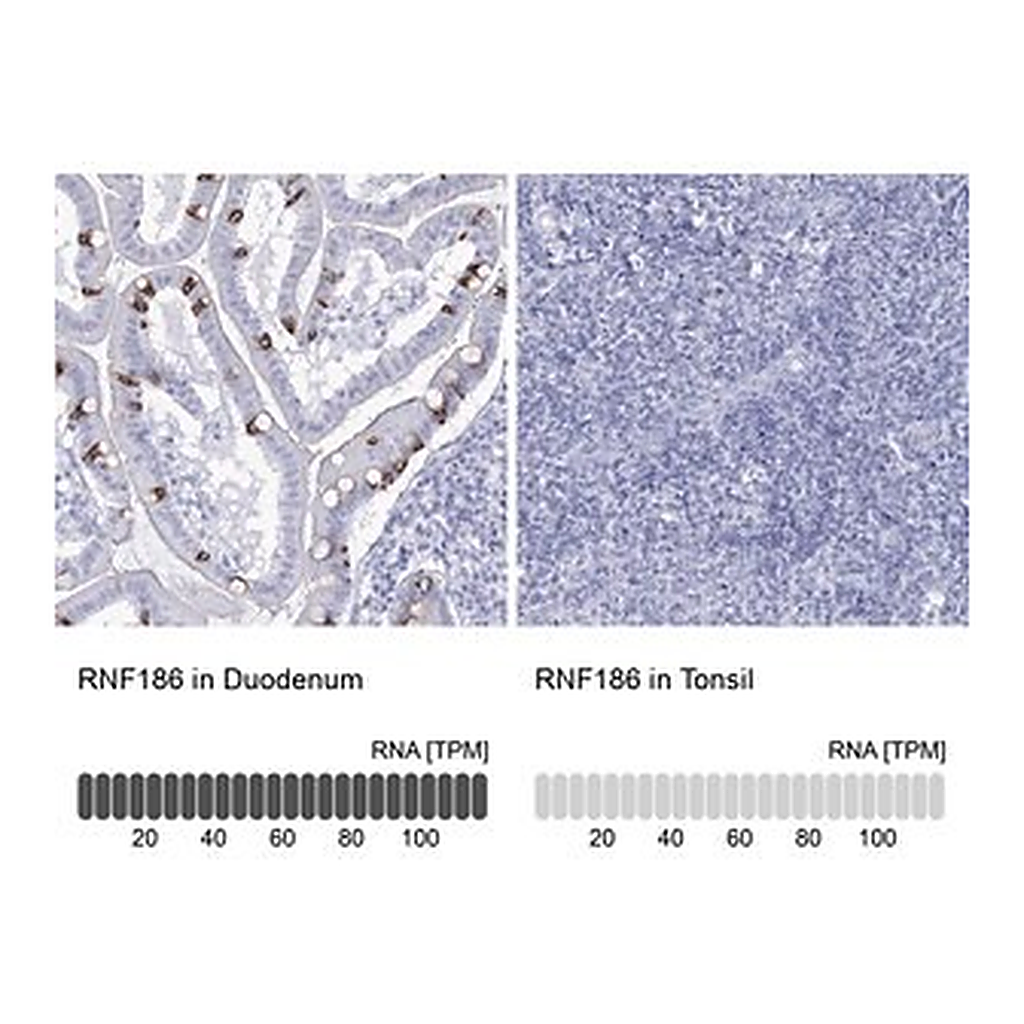 Merck Anti-RNF186 antibody produced in rabbit