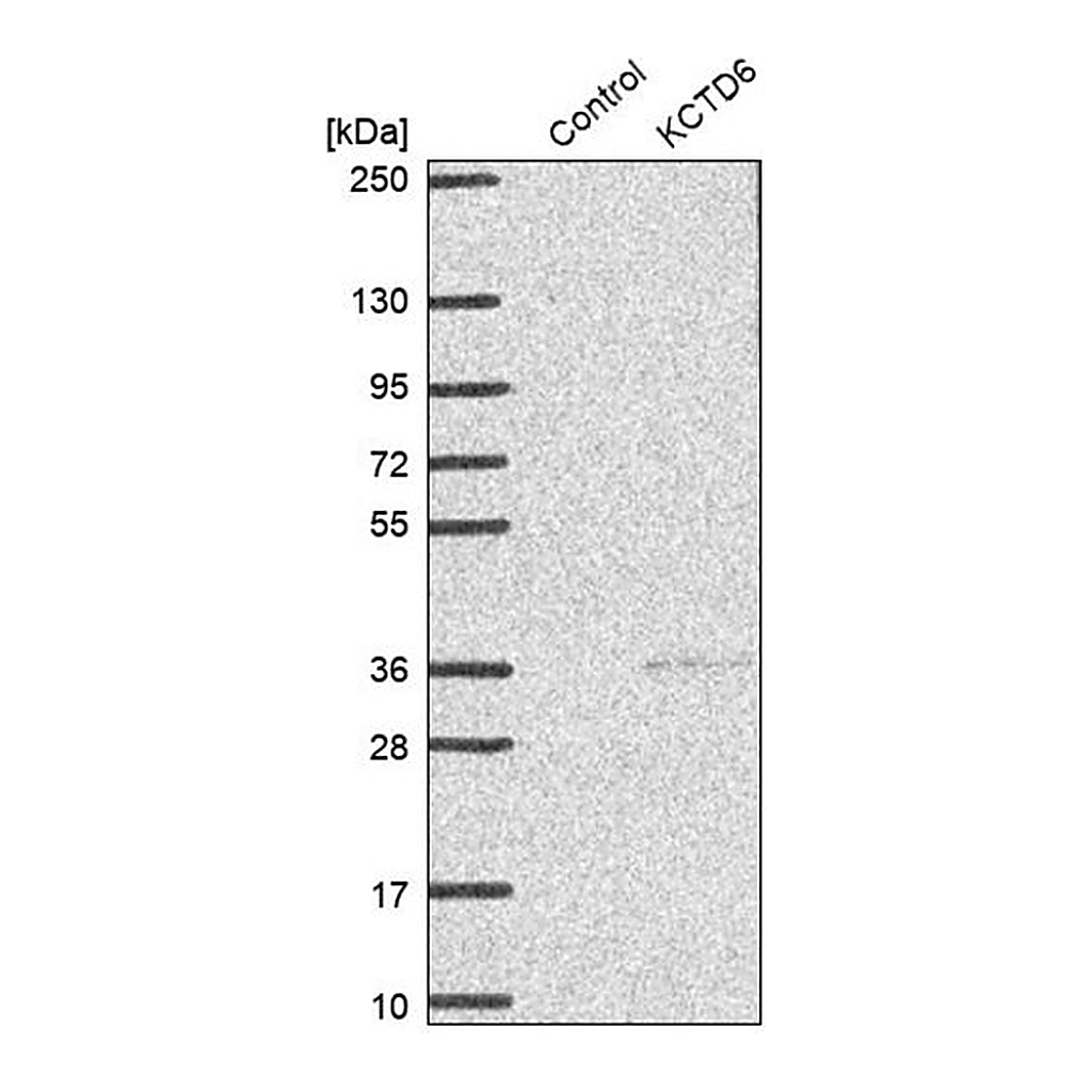 Merck Anti-KCTD6 antibody produced in rabbit