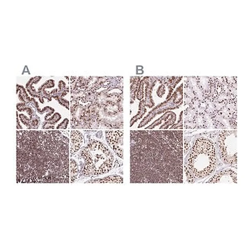 Merck Anti-XRCC6 antibody produced in rabbit