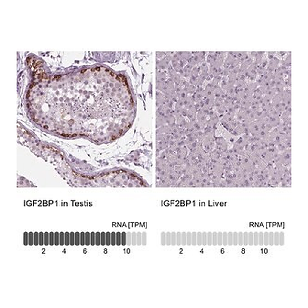 Merck Anti-IGF2BP1 antibody produced in rabbit