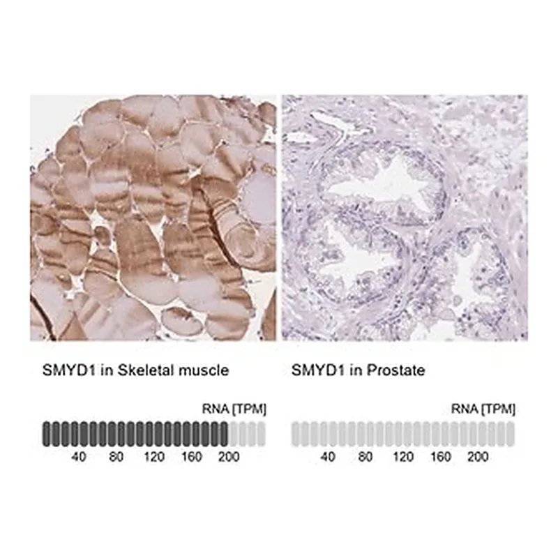 Merck Anti-SMYD1 antibody produced in rabbit