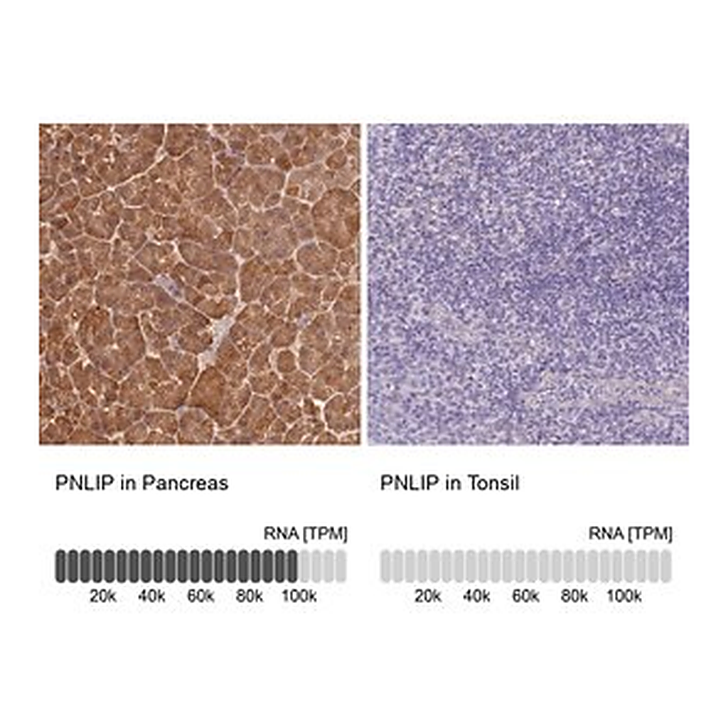 Merck Anti-PNLIP antibody produced in rabbit