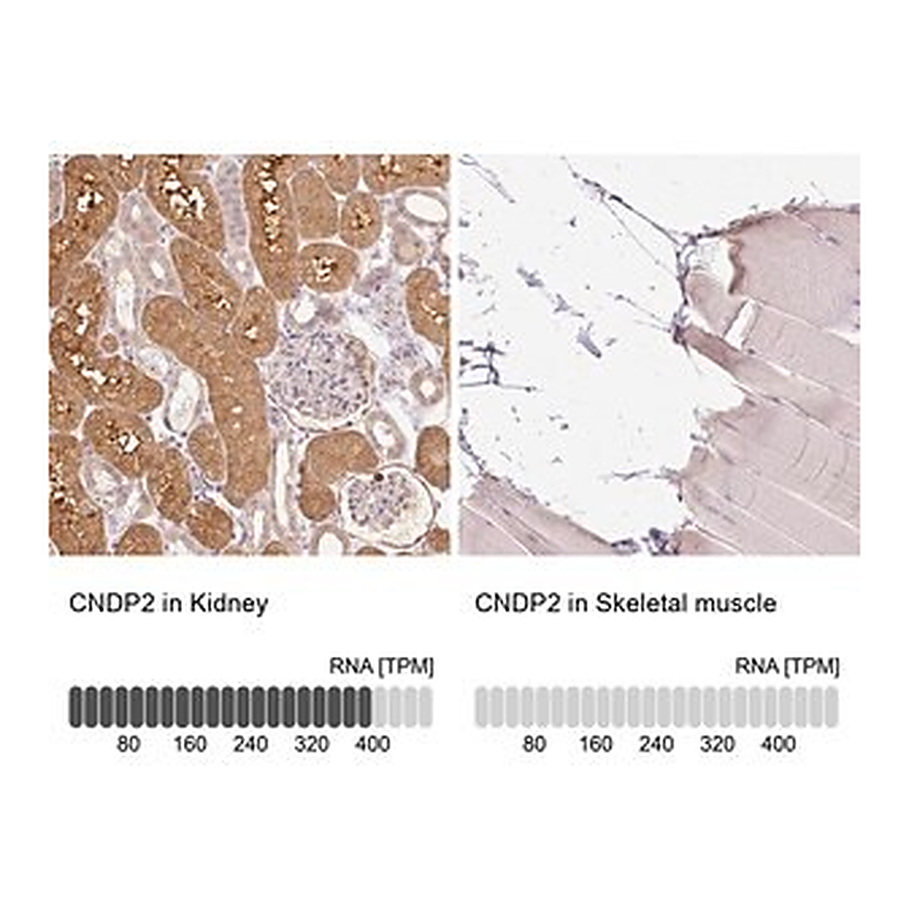 Merck Anti-CNDP2 antibody produced in rabbit