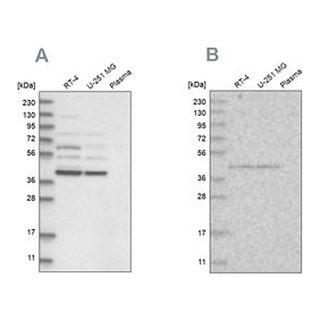 Merck Anti-GPN1 antibody produced in rabbit