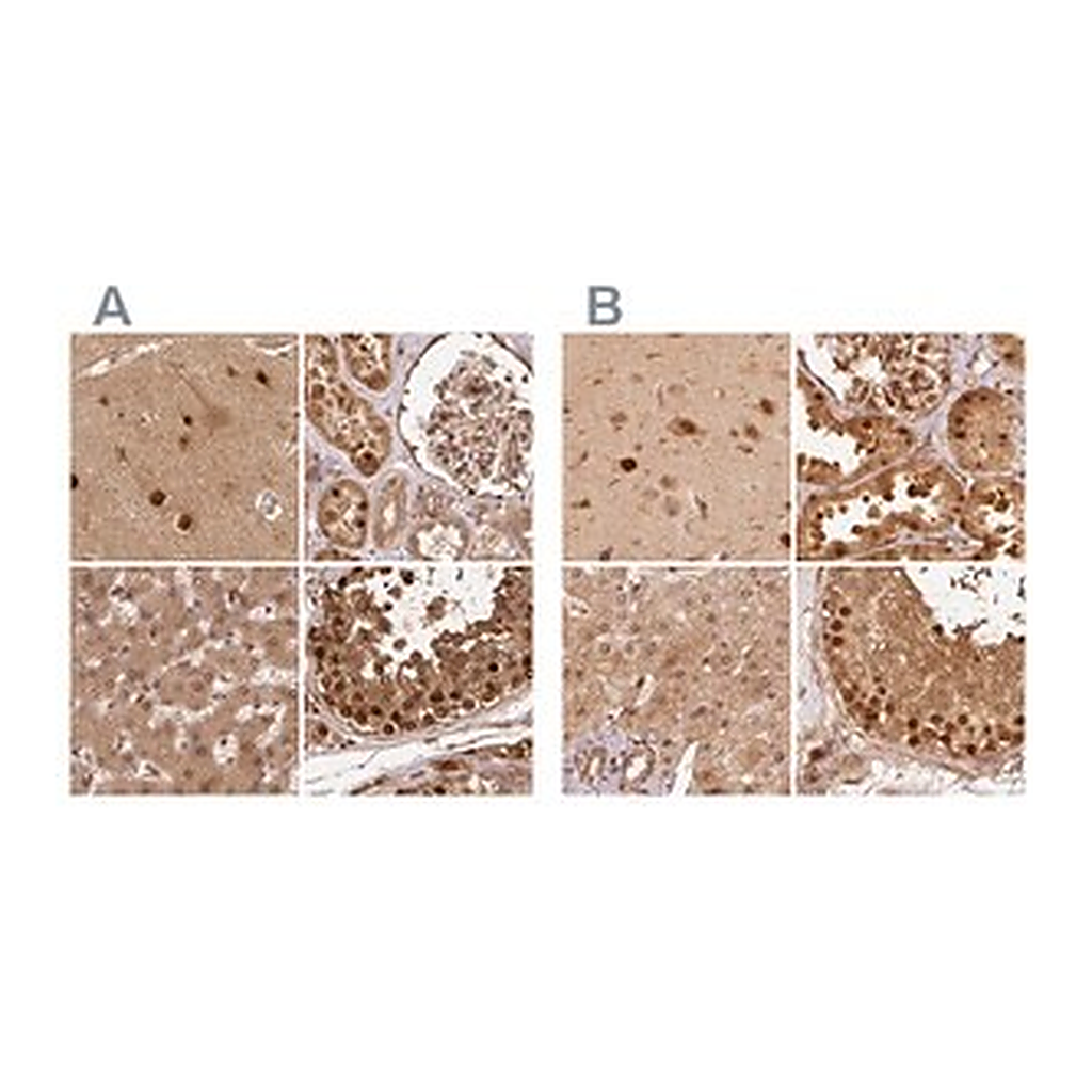 Merck Anti-PSMD1 antibody produced in rabbit