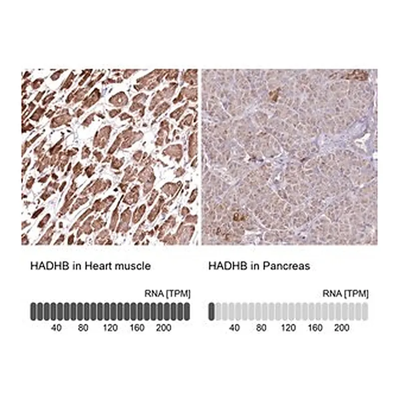 Merck Anti-HADHB antibody produced in rabbit