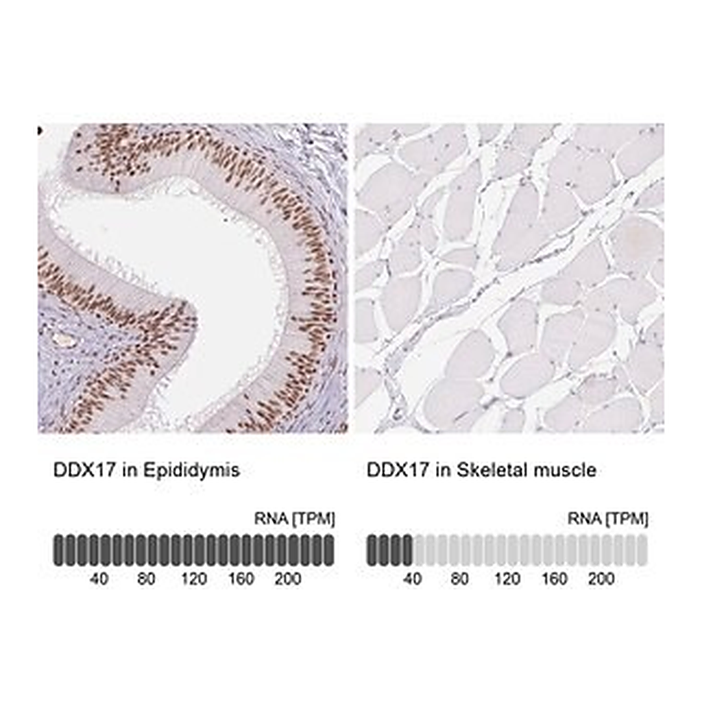 Merck Anti-DDX17 antibody produced in rabbit
