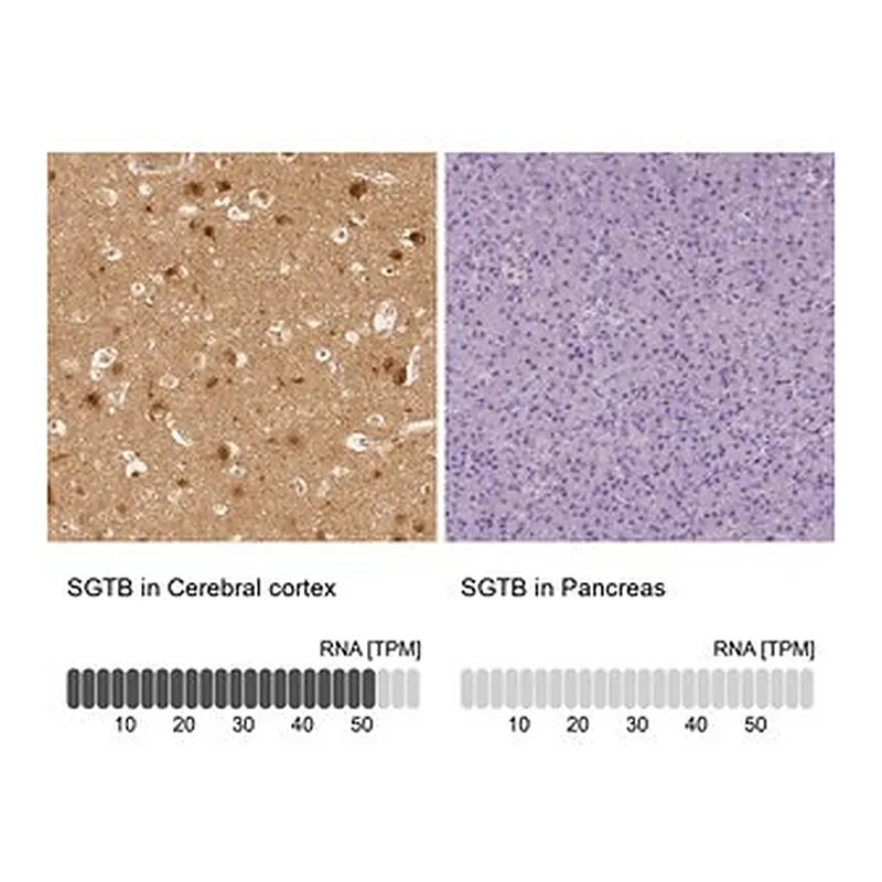 Merck Anti-SGTB antibody produced in rabbit