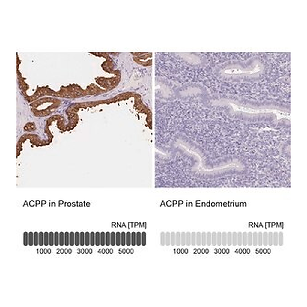 Merck Anti-ACPP antibody produced in rabbit