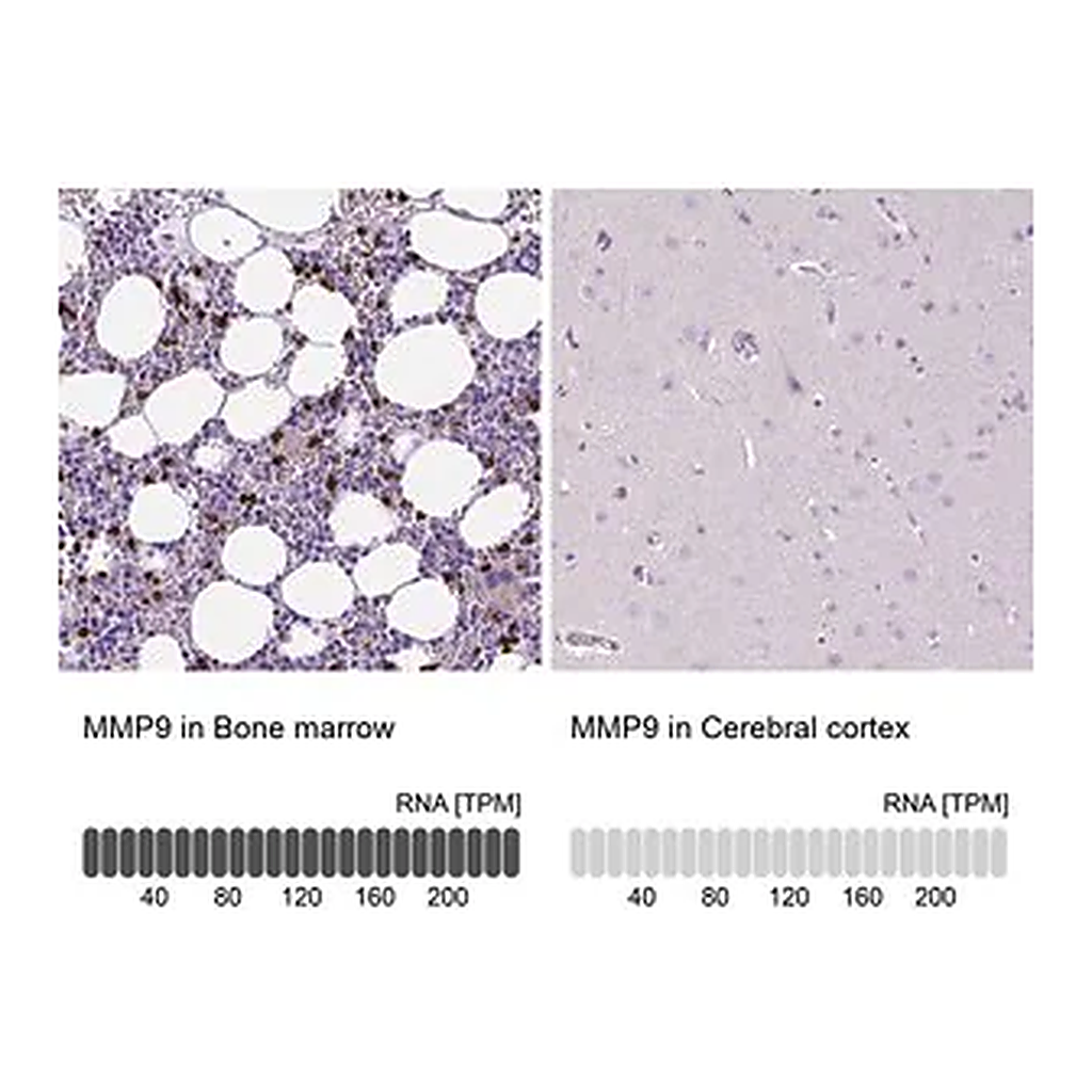 Merck Anti-MMP9 antibody produced in rabbit