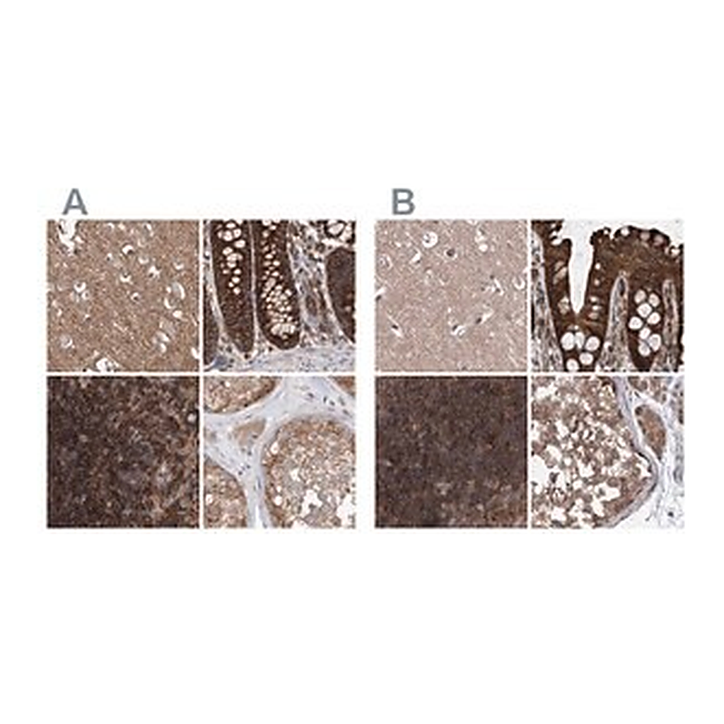 Merck Anti-VPS37B antibody produced in rabbit