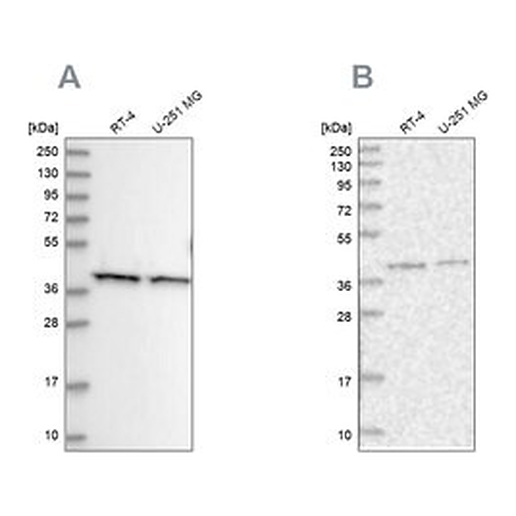 Merck Anti-PSMD13 antibody produced in rabbit