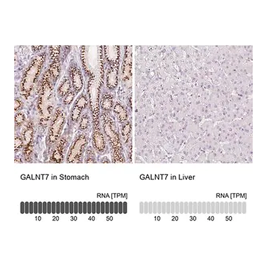 Merck Anti-GALNT7 antibody produced in rabbit