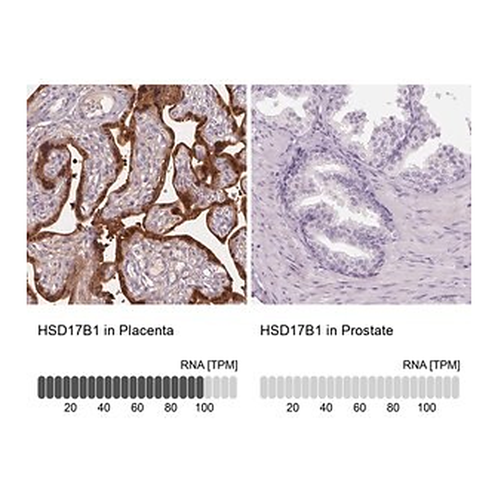 Merck Anti-HSD17B1 antibody produced in rabbit