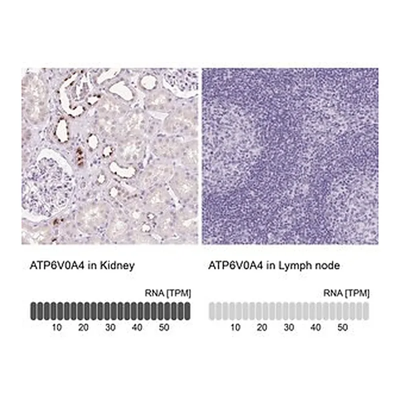 Merck Anti-ATP6V0A4 antibody produced in rabbit